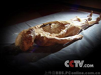 医务人员对女尸进行解剖发现,在女尸的腹腔里有竟然有大量的水银.