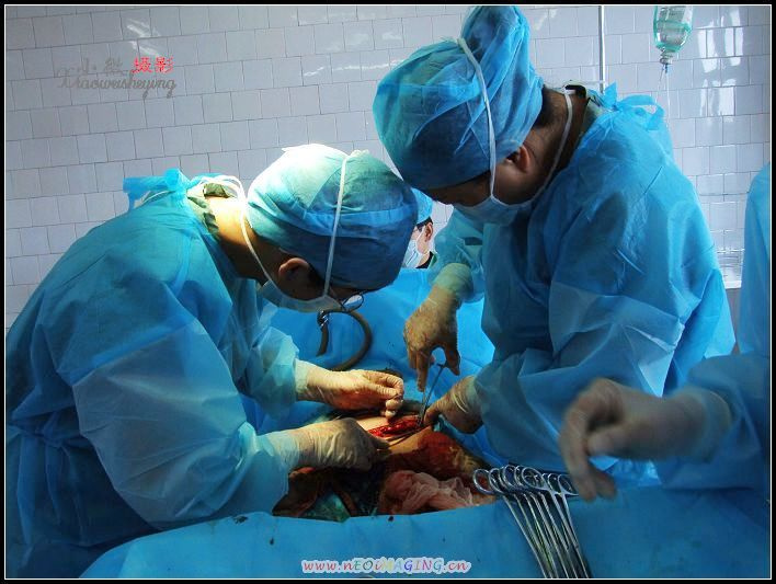 【妇产科医生的手摄影图片】手术室纪实摄影_小微的