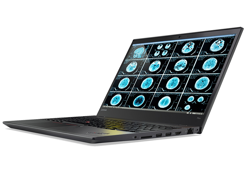 联想ThinkPad P51s(20HBA011CD)侧视