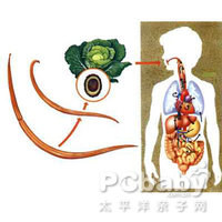 肠道蛔虫感染