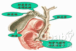 先天性肝内胆管囊状扩张症