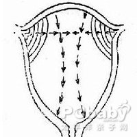 子宫收缩乏力