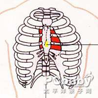 概述 症状 串珠肋 概述                      串珠肋是指在肋骨和肋