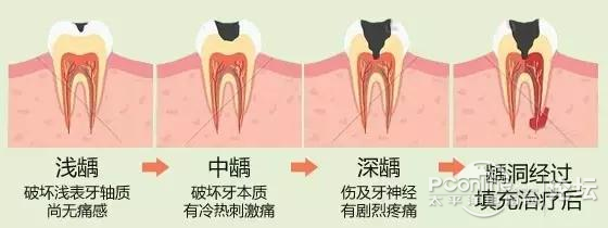 鿴